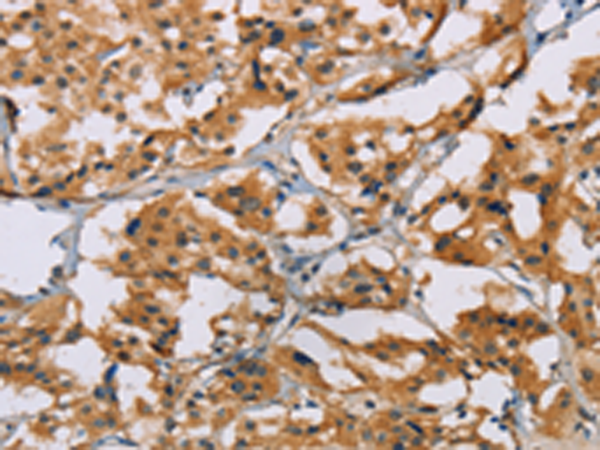 Rabbit Polyclonal Antibody to NRN1