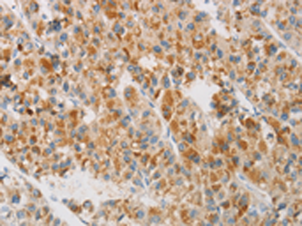 Rabbit Polyclonal Antibody to NGB