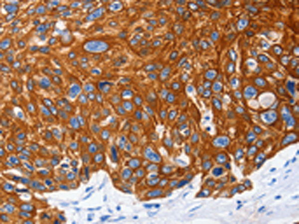 Rabbit Polyclonal Antibody to NFATC1
