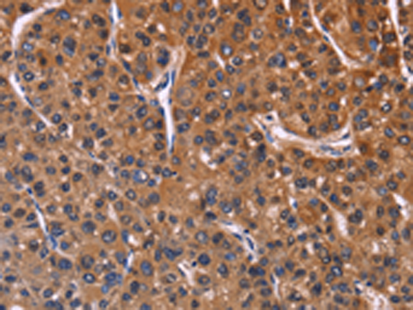 Rabbit Polyclonal Antibody to NFATC3