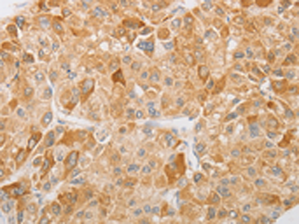 Rabbit Polyclonal Antibody to NGF
