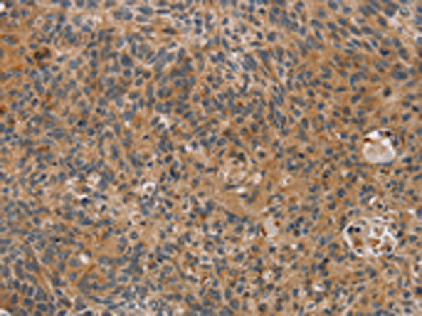 Rabbit Polyclonal Antibody to TAC1