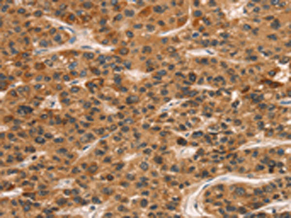 Rabbit Polyclonal Antibody to KLRC1