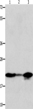 Rabbit Polyclonal Antibody to NME1