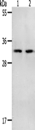 Rabbit Polyclonal Antibody to NME6