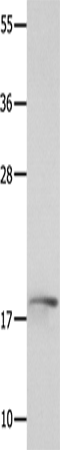 Rabbit Polyclonal Antibody to NME3