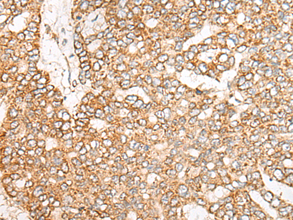 Rabbit Polyclonal Antibody to NME4