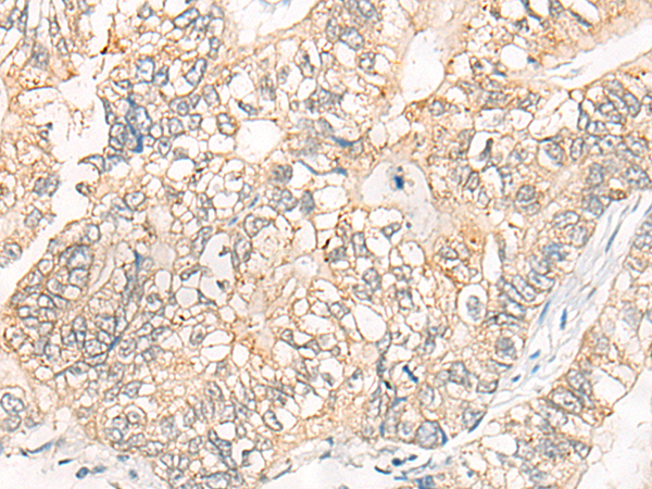 Rabbit Polyclonal Antibody to RTN4R