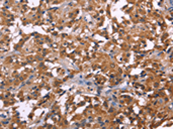 Rabbit Polyclonal Antibody to NOS2