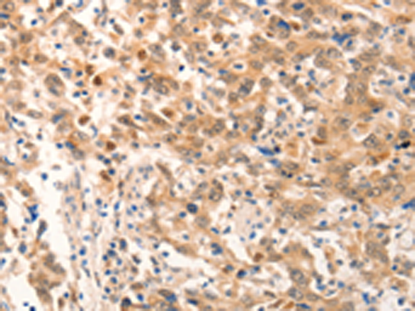 Rabbit Polyclonal Antibody to NOX4