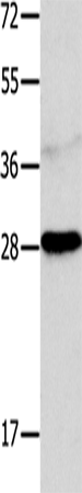 Rabbit Polyclonal Antibody to NTF4