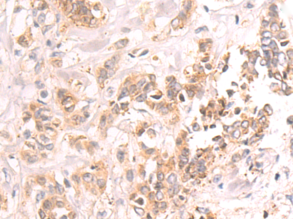 Rabbit Polyclonal Antibody to NR4A2