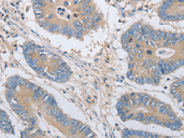 Rabbit Polyclonal Antibody to OASL