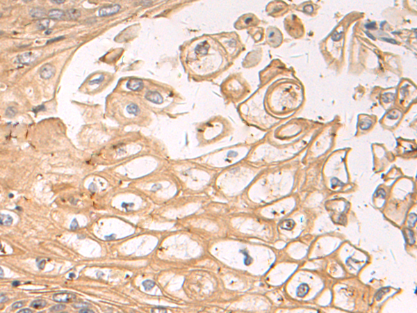 Rabbit Polyclonal Antibody to OCLN