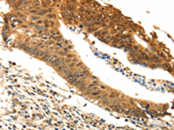 Rabbit Polyclonal Antibody to ODC1