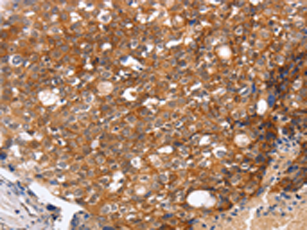 Rabbit Polyclonal Antibody to OMG