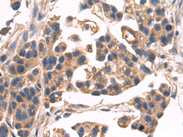 Rabbit Polyclonal Antibody to TNFRSF11B
