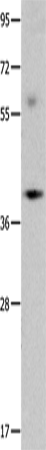 Rabbit Polyclonal Antibody to OPCML