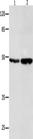 Rabbit Polyclonal Antibody to SPP1