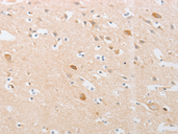 Rabbit Polyclonal Antibody to CDKN2AIP