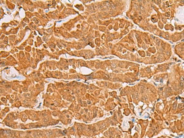 Rabbit Polyclonal Antibody to MAPK14