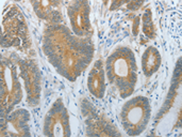 Rabbit Polyclonal Antibody to DNAJC3
