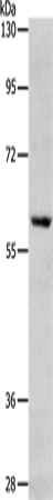 Rabbit Polyclonal Antibody to RPS6KB1