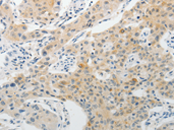 Rabbit Polyclonal Antibody to PADI4