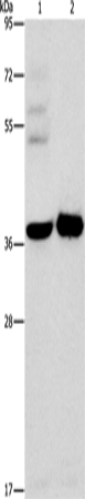 Rabbit Polyclonal Antibody to SERPINE2