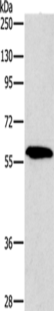 Rabbit Polyclonal Antibody to PAK2