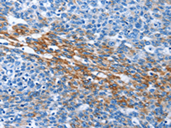 Rabbit Polyclonal Antibody to PAK6