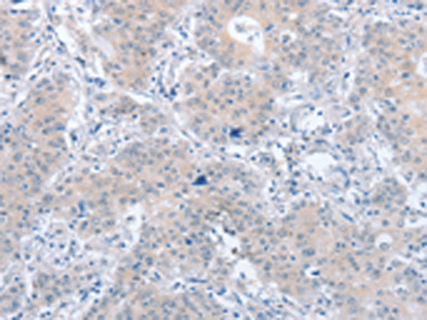 Rabbit Polyclonal Antibody to PARD6A