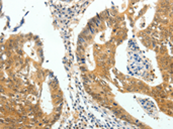 Rabbit Polyclonal Antibody to CDH23