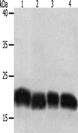 Rabbit Polyclonal Antibody to PDCD6