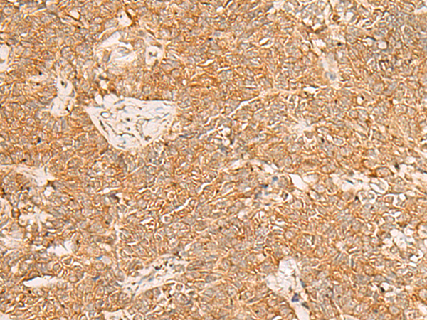 Rabbit Polyclonal Antibody to PDCD4