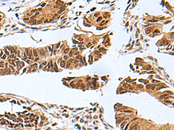 Rabbit Polyclonal Antibody to PDCD5