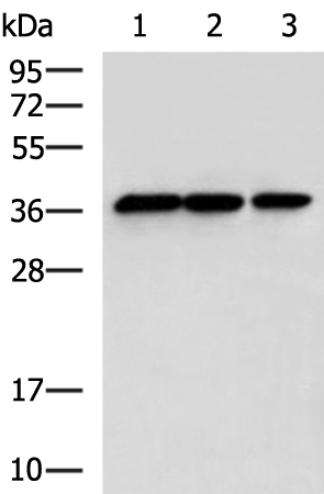 Rabbit Polyclonal Antibody to SPDEF