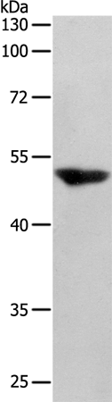 Rabbit Polyclonal Antibody to SERPINF1