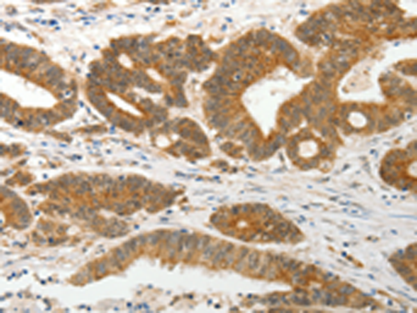 Rabbit Polyclonal Antibody to PRPH