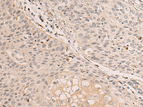 Rabbit Polyclonal Antibody to GRN