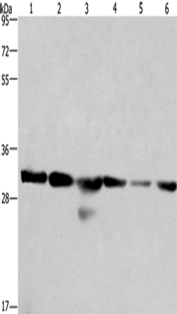 Rabbit Polyclonal Antibody to PHB