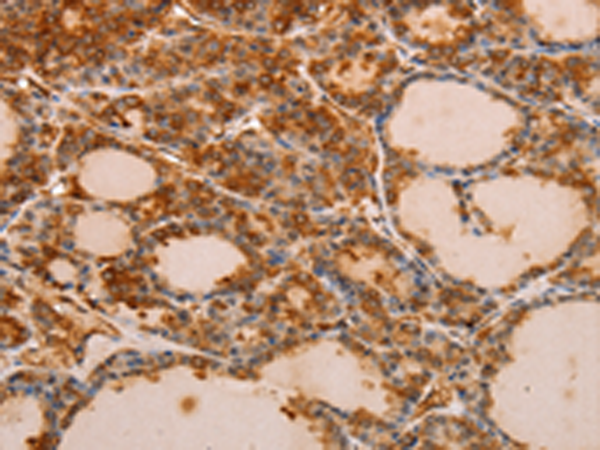 Rabbit Polyclonal Antibody to PIK3R1