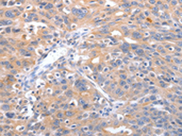 Rabbit Polyclonal Antibody to RCHY1