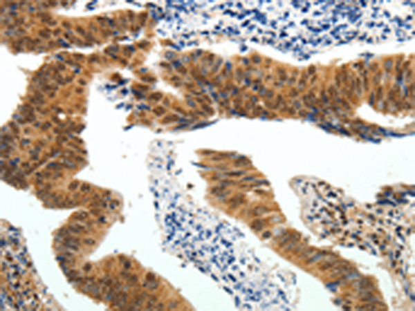 Rabbit Polyclonal Antibody to PIWIL4
