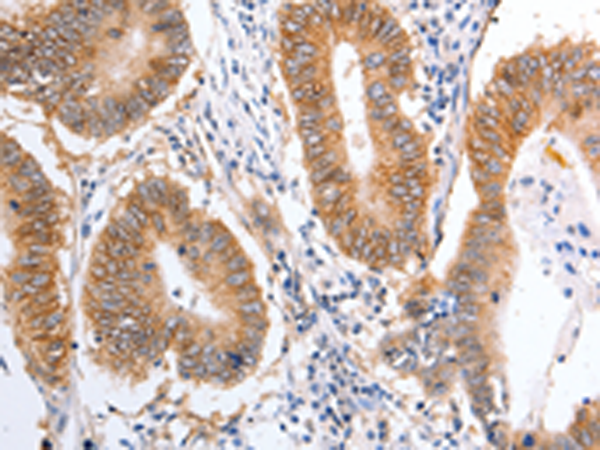 Rabbit Polyclonal Antibody to PIWIL1