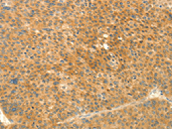 Rabbit Polyclonal Antibody to PRKACG