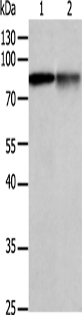 Rabbit Polyclonal Antibody to PRKCA