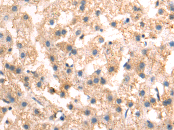 Rabbit Polyclonal Antibody to PLAU