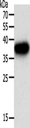 Rabbit Polyclonal Antibody to PLAUR