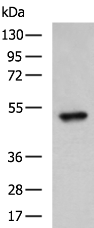 Rabbit Polyclonal Antibody to PGF
